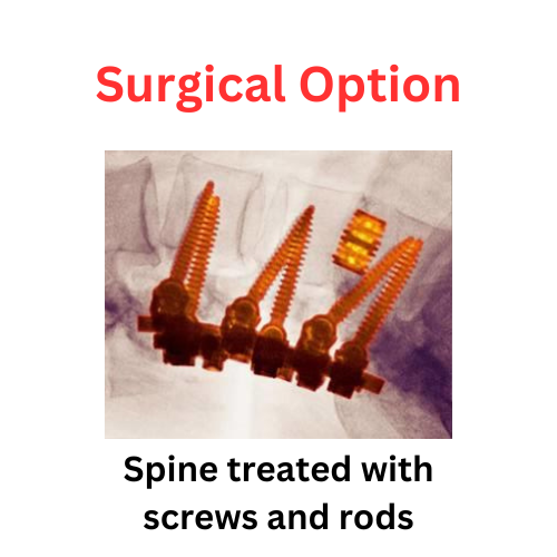 Spine Treated with microscopic needles (1)